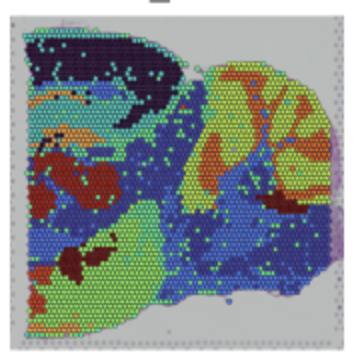 Spatial Transcriptomics Workshop